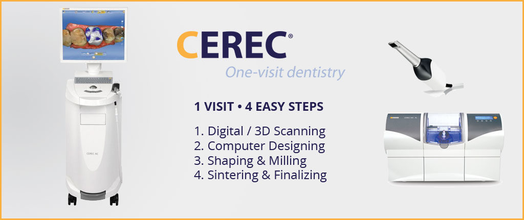 CEREC Crown Benefits