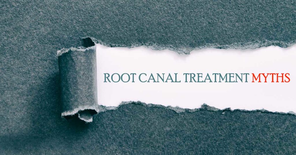 root canal treatment myths